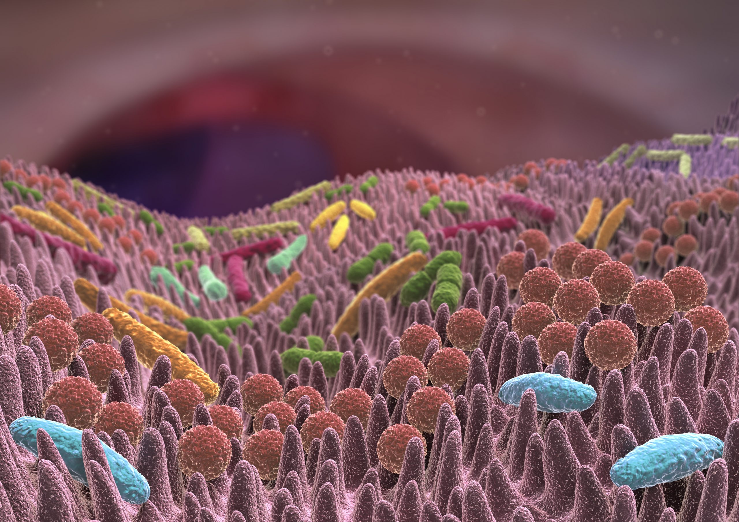 microbiote intestin syndrome de fatigue chronique SFC EM